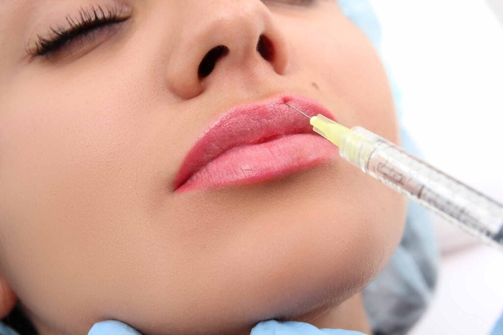 Services » Filler Injections